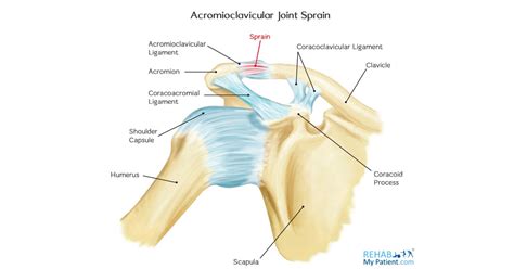 Acromioclavicular Ac Joint Injuries