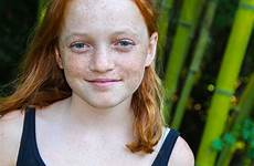 year chested freckles readhead freckels redheads