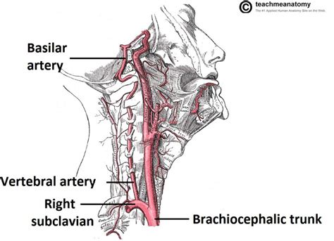 Carotid artery disease occurs when fatty deposits (plaques) clog the blood vessels that deliver blood to your brain and head (carotid arteries). Major Arteries of the Head and Neck - Carotid - TeachMeAnatomy