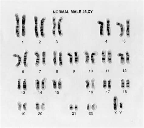 Normal Male 46xy Human Karyotype Wellcome Collection