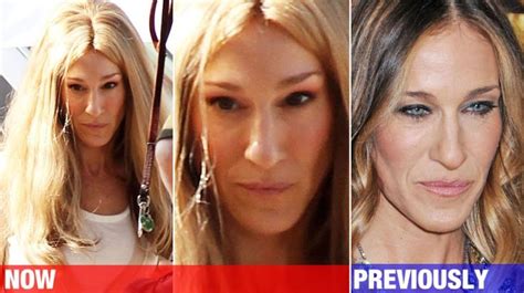 Sarah Jessica Parker Before And After Plastic Surgery 1 Celebrity