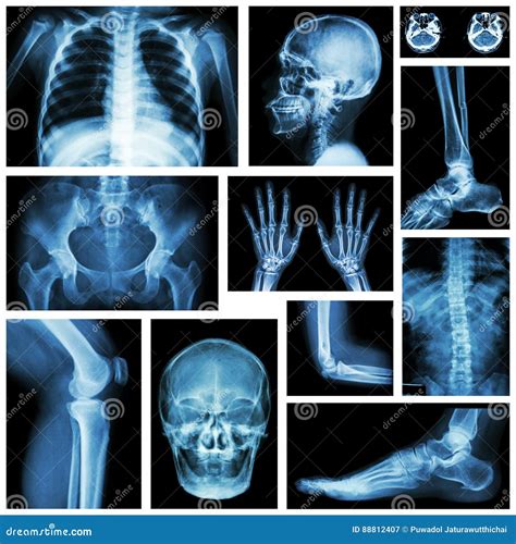 Set Of X Ray Multiple Part Of Human Skeletal System Stock Image