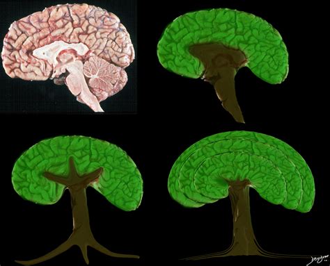 Trees In The Brain Medical Art