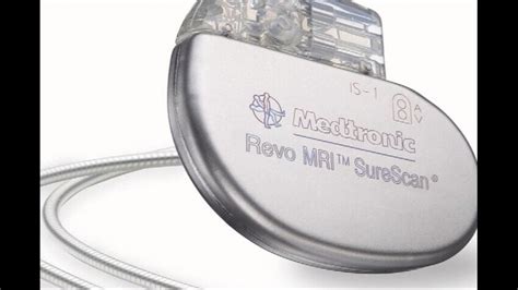 Mri Safe Pacemakers Now Available