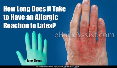 How Long Does It Take To Have An Allergic Reaction To Latex