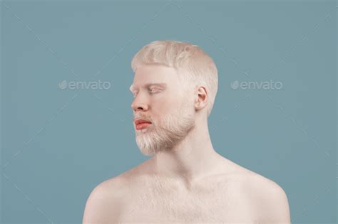 Uncommon Appearance Concept Albino Guy With Naked Shoulders Posing Over Turquoise Studio