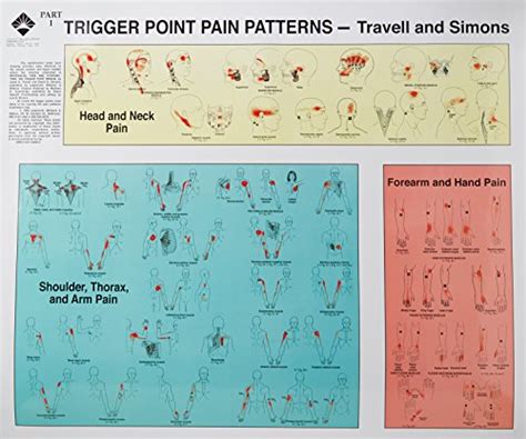 Trigger Points Of Pain Wall Charts Set Of 2 Wantitall