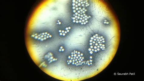 Cryptococcus Neoformans With Capsules Youtube