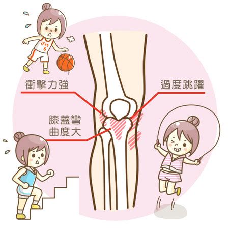 为了让肌肉变得灵活，防止在高强度运动中受伤，你必须先做热身运动，把肌肉激活。 不能跳过准备步骤直接开始高强度运动。 先做轻度锻炼，逐渐增加强度。 1 x 研究来源 比如，如果你要举重，不能从重量级杠铃开始，应该先练习轻量级的，之后再练高强度的仰卧推举。 iFit愛瘦身／保護膝蓋的好運動 有效護膝不傷膝 | ETtoday名家新聞 | ETtoday 新聞雲