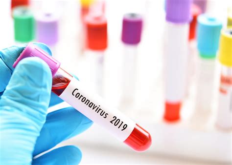 ตระหนัก เรียนรู้ ป้องกันไวรัสโคโรนาสายพันธุ์ใหม่ 2019 จุฬาลงกรณ์