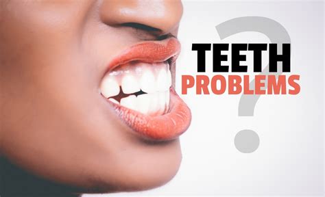 Fixing The Most Common Teeth Problems - Fitneass