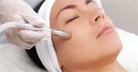 Six Benefits Of Microdermabrasion Herald Health