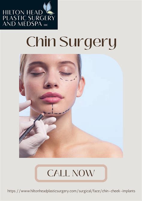 All You Need To Know Chin Surgery By Hilton Head Plastic Surgery And Medspa Medium