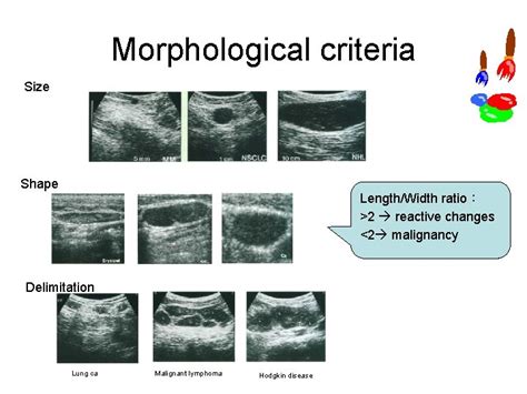 Lymph Nodes Differential Diagnosis In Ultrasound Imaging P