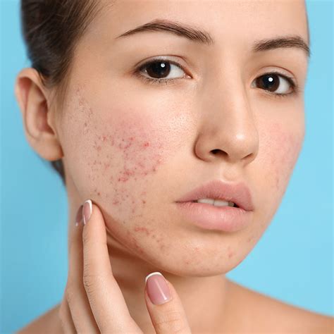 Skin Conditions Sigma Dermatology