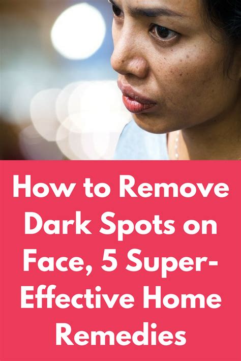 How To Remove Dark Spots On Face 5 Super Effective Home Remedies Be It