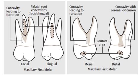 Hand Instrumentation Of First Molar Teeth Dimensions Of Dental