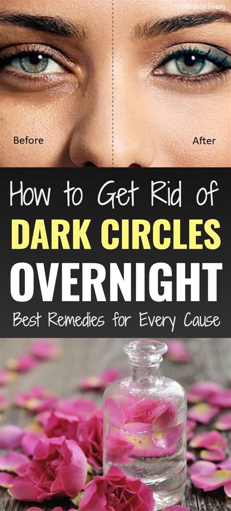 How To Get Rid Of Dark Circles Overnight Best Remedies For Every