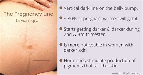 Linea Nigra The Dark Pregnancy Line On My Belly Bump My Lilli Pilli