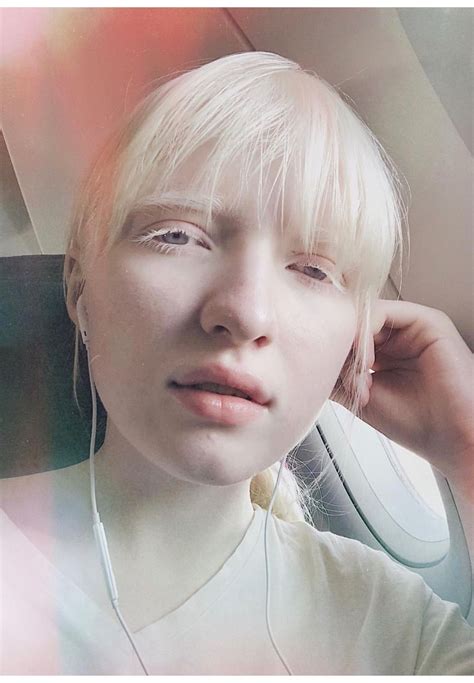 Pin On Albino Girl