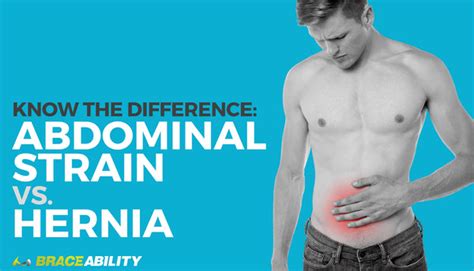 Know The Difference Abdominal Strain Vs Hernia