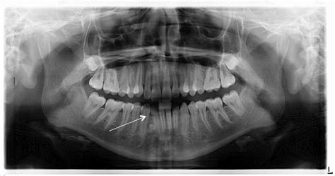 Breakthrough Clinical Oral Pathology Cases 1 12 Oral Pathology