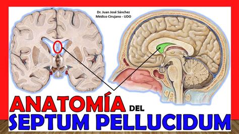Anatom A Del Septum Pellucidum Explicaci N R Pida Y Sencilla Youtube