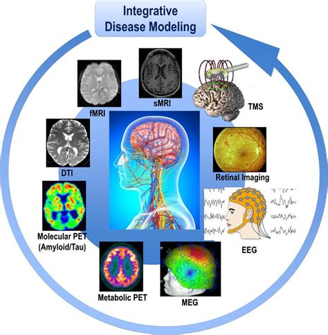 Revolution Of Alzheimer Precision Neurology Passageway Of Systems