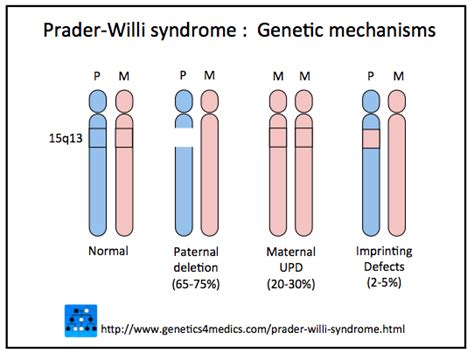 Etiology Prader Willi Syndrome