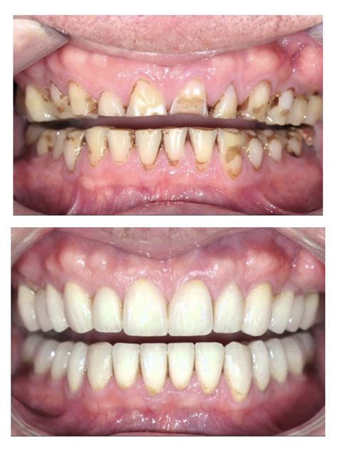 Clínica Dental OrÉ Odontología Especializada Implantología Oral