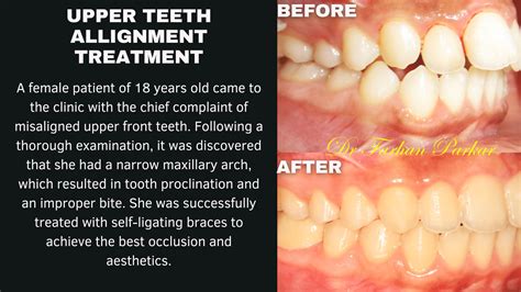 Bliss Skin, Hair and Dental | Bliss Skin and Dental Clinic in Bandra