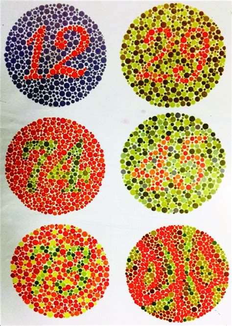 Ishihara Chart For Color Blindness Test Download Scientific Diagram
