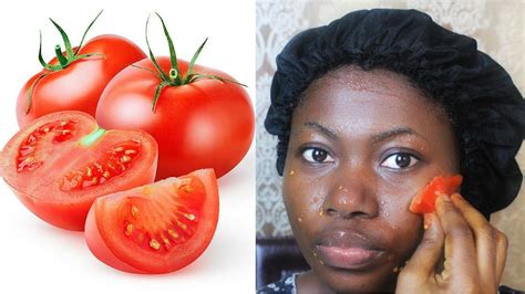 How To Use Tomato For Acne Beauty Benefits FabWoman