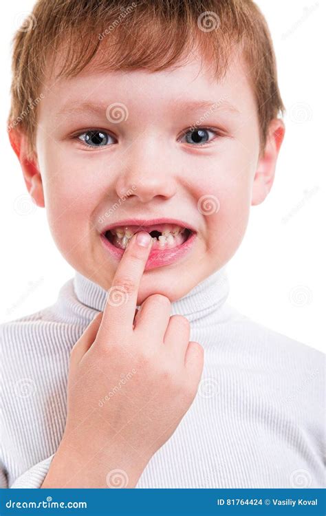 Boy Showing His Missing Milk Teeth Stock Photo Image Of Clean Baby