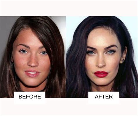 Celebrity Plastic Surgery: 31 Before And After Images