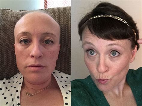 Chemo Curls A Journey Through Pictures See The Incredible