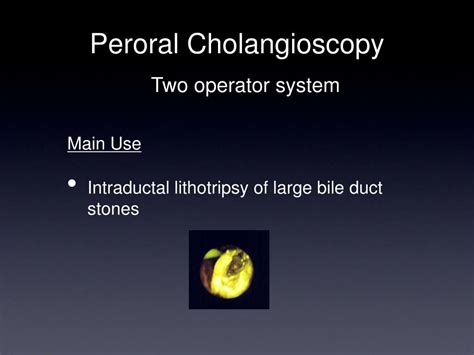 Ppt Cholangioscopy Powerpoint Presentation Free Download Id3430087