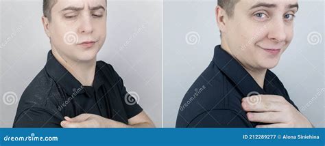 Dandruff Before And After The Man On The Left Shows His Shoulder