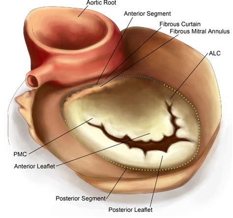 Figure 1 From Mitral Annulus An Intraoperative Echocardiographic