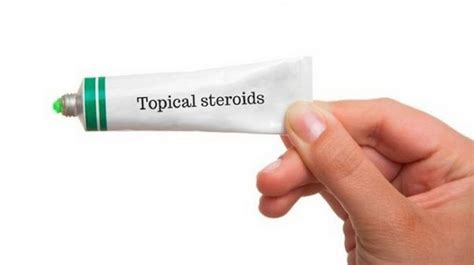 Topical Steroids Uses Side Effects Withdrawal Symptoms And