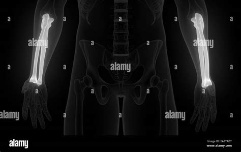 Human Skeleton System Bone Joints Anatomy X Ray 3d Rendering Stock