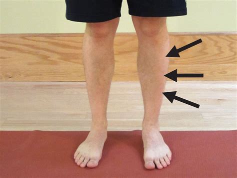 How To Prevent Shin Splints The Physical Therapy Advisor