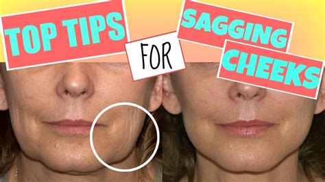 How To Get Rid Of Sagging Facecheeks Top Tips Solutionsroom Youtube