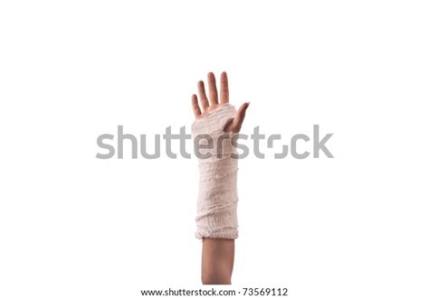 Broken Hand Cast Isolated On White Stock Photo Edit Now 73569112
