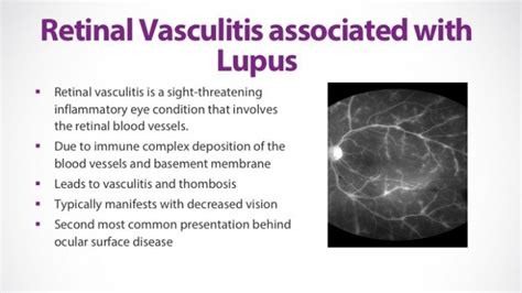 Lupus And The Eye