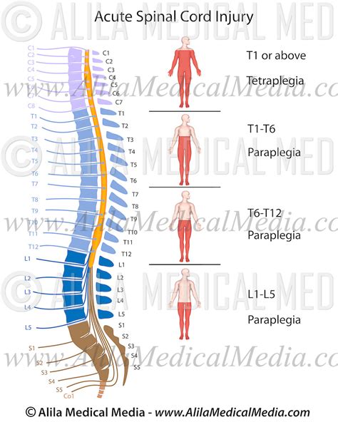 Spinal Cord Injury Levels V2 Alila Medical Images