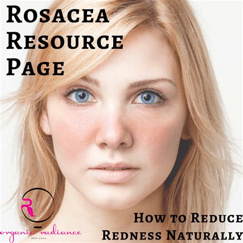 Rosacea Resources Articles On How To Reduce Redness Naturally By