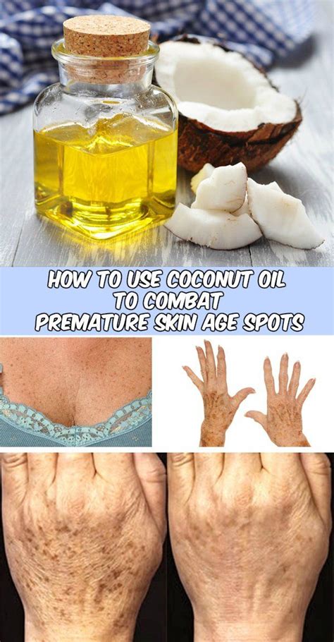 How To Use Coconut Oil To Combat Premature Skin Age Spots We Love
