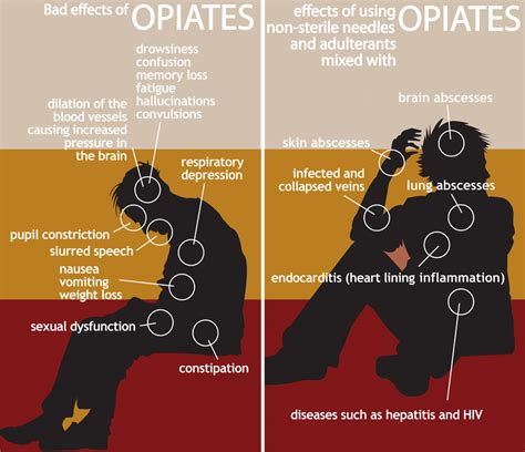 Bad Effects Of Opiates Abuse