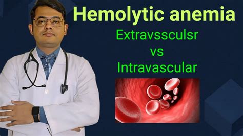 Hemolytic Anemia Extravsscular Vs Intravascular Simplified